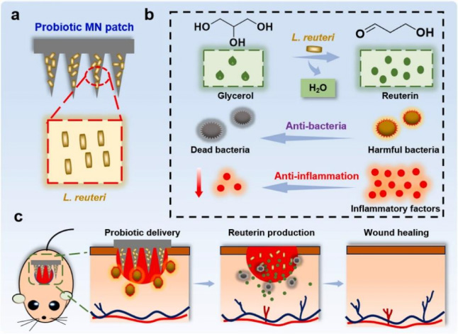 武汉大学药学院黎威教授课题组《Bioactive Materials》：具有长效抗菌效果的活性益生菌微针贴片用于感染创面快速愈合